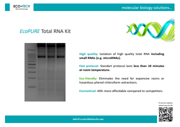 EcoPURE Total RNA Kit