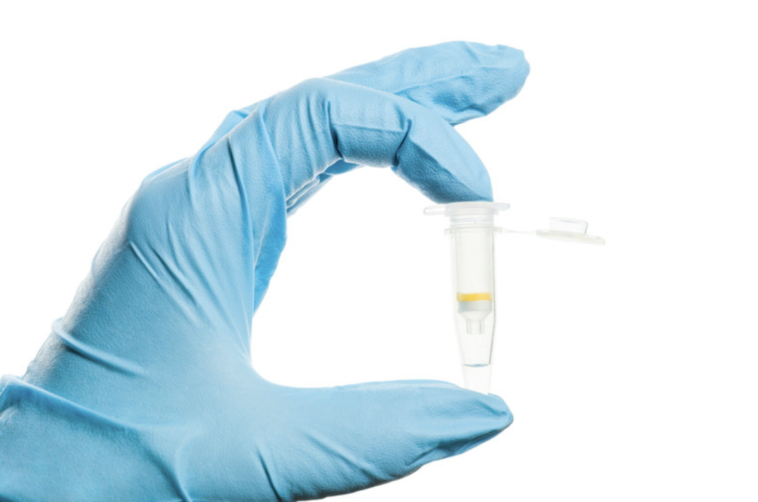 Gloved hand holding a nucleic acid purification spin column